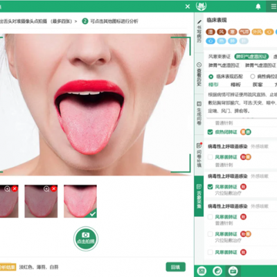 岐缘数智®中医舌诊系统