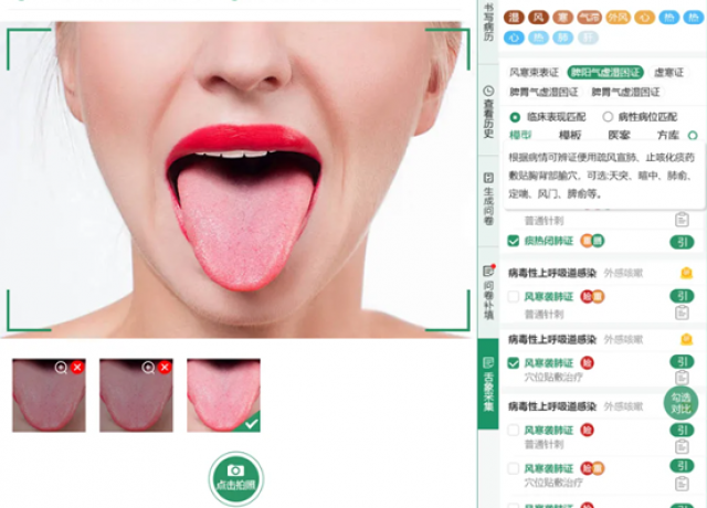 岐缘数智®中医舌诊系统